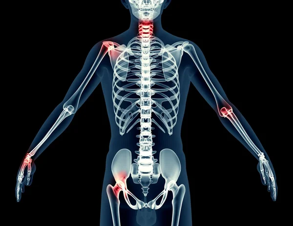 X-ray görüntü üzerinde siyah izole bir adamın — Stok fotoğraf