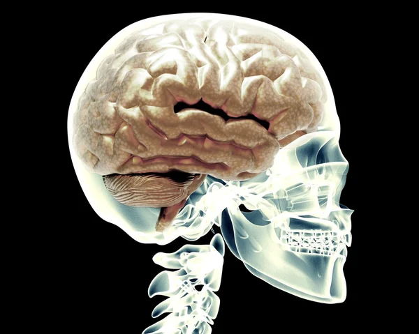X-ray scull met hersenen — Stockfoto