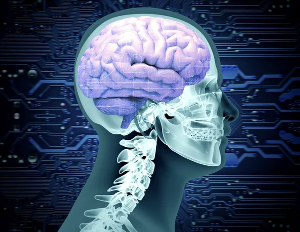 脳と回路基板のチップを搭載したスカルの x 線像 — ストック写真