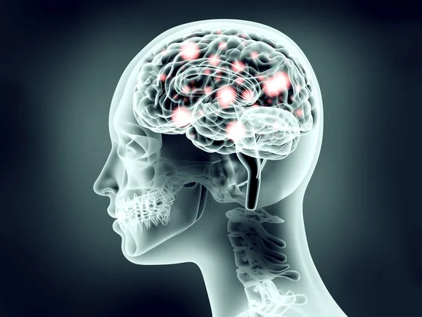 脳と電気パルスの人体頭部の x 線のイメージ — ストック写真