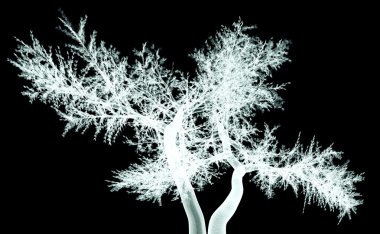 x-ray görüntü üzerinde siyah izole bir ağacın