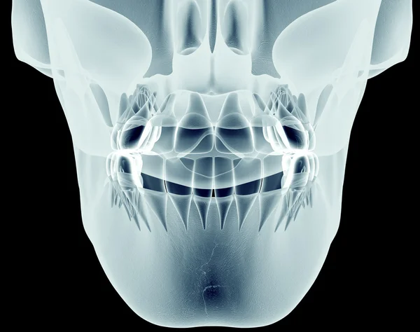 Imagen de rayos X de una mandíbula con dientes — Foto de Stock