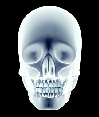 bir kafatası dişleri olan x-ray görüntüsü