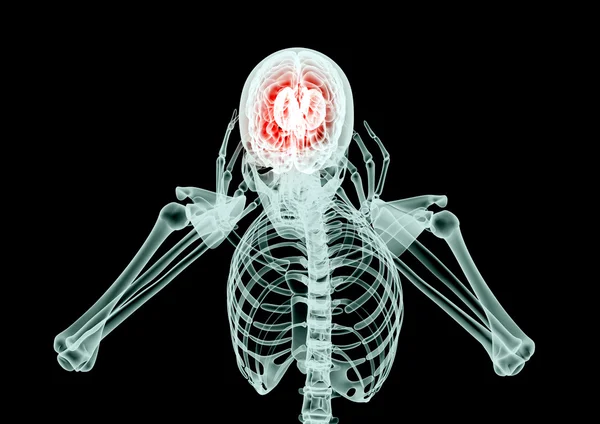 Imagen de rayos X de un hombre con dolor en negro con camino de recorte —  Fotos de Stock