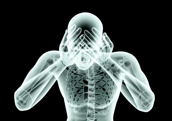 Zdjęcie rentgenowskie człowieka na czarno ze ścieżką przycinającą — Zdjęcie stockowe