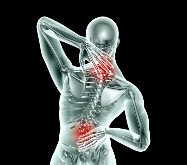 X-ray afbeelding man met pijn in de rug met uitknippad — Stockfoto