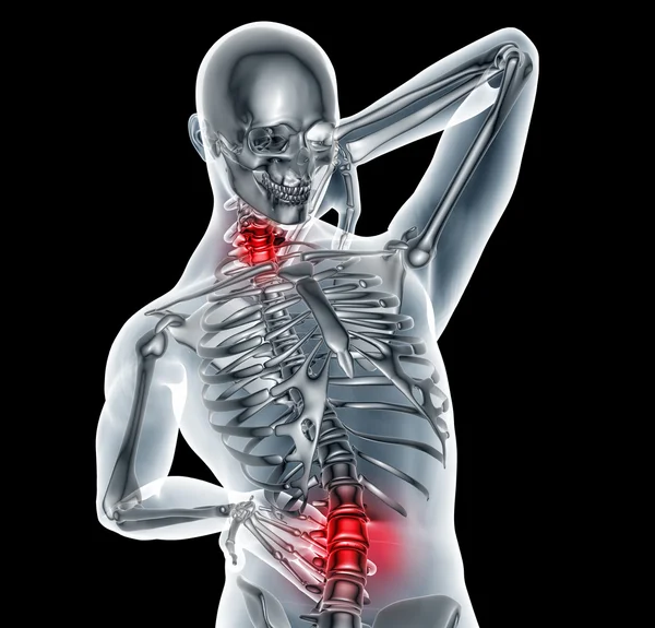 Immagine a raggi x uomo con mal di schiena con percorso di ritaglio — Foto Stock