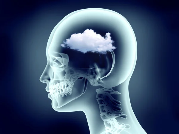 XRay emberi fejét a felhők képe — Stock Fotó