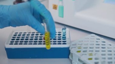 Yakın plan Kimyager, Mikropipet kullanarak Kimyasalları Karıştırdı. COVID-19 'a Karşı Potansiyel Uyuşturucu ve Aşıların Geliştiricileri.