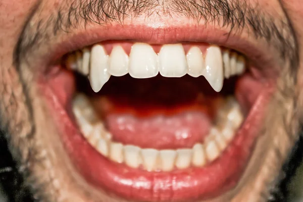 Dentes de vampiro afiados — Fotografia de Stock