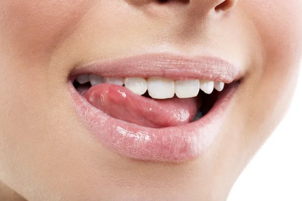 Perfect smile after bleaching — Stock Photo, Image