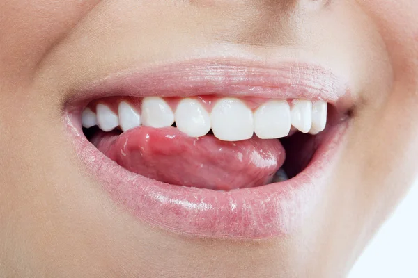 Sonrisa perfecta después del blanqueo — Foto de Stock