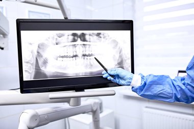 Diş röntgeni çekilen doktor ya da diş hekiminin görüntüsü hastaya diş ve diş hekimliği tedavisinde ve iş yerinde çalışma önerisinde bulunuluyor..