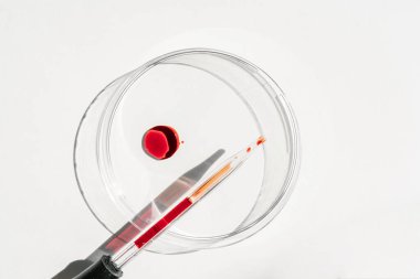 El, içinde kan olan bir test tüpü tutuyor..