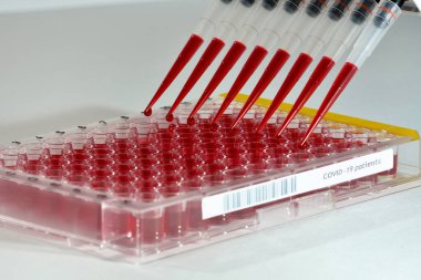 Çokkanallı pipet ile mikro ölçekli covid-19 örneklerinin yüksek içerikli taraması