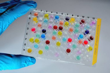 Covid-19 numune plaka mutant rengarenk taraması. Bilim adamı 96 kuyu mikro plakası tutuyor.