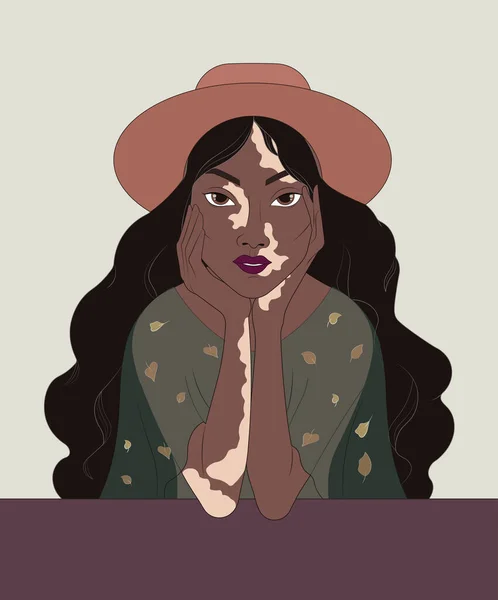 Hermosa cara de moda femenina con Vitiligo — Vector de stock