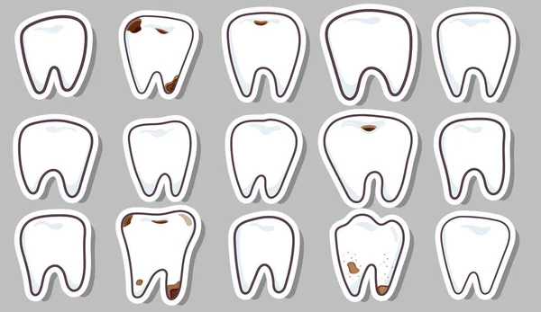 Наклейки Зубами Здорові Погані Зуби — стокове фото