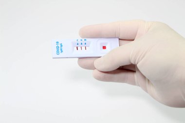 Coronavirus SARS-CoV-2 COVID-19 antikorlarını tanımlayan hızlı tanı testi kaseti tutan bir tıp çalışanı.