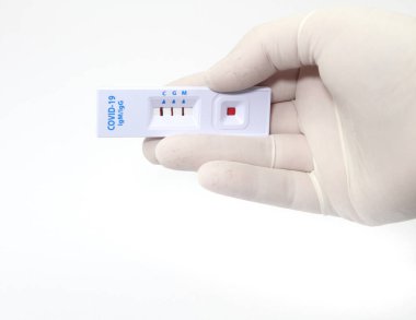 Coronavirus SARS-CoV-2 COVID-19 antikorlarını tanımlayan hızlı tanı testi kaseti tutan bir tıp çalışanı.