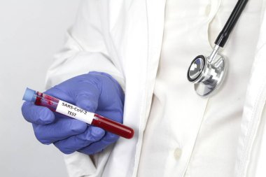 Sağlık çalışanı, Covid-19 virüs testi için kan örneği içeren test tüpü tutuyor.