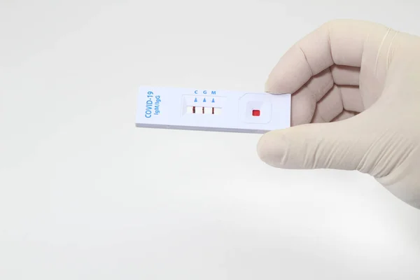 Medical worker holding positive rapid Diagnostic Test cassette identifying antibodies for Coronavirus SARS-CoV-2 COVID-19