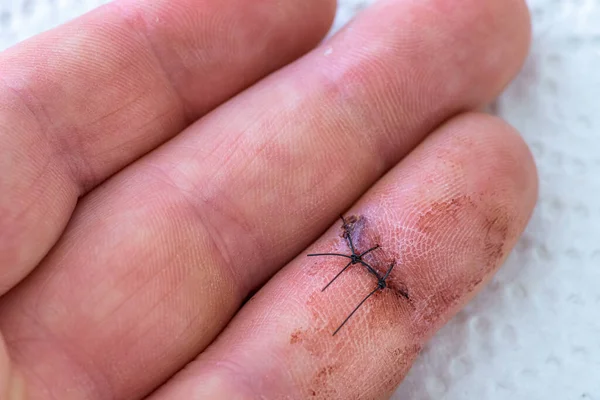 Kafkas yüzük parmağında dikiş, seçici odaklanma