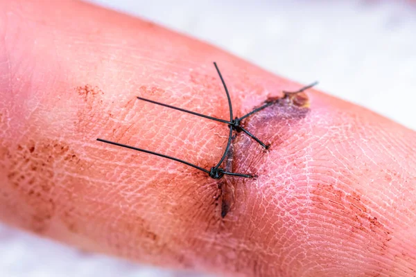 Kafkas parmağıyla dikişe yakın dur. Sığ alan derinliği, seçici odak