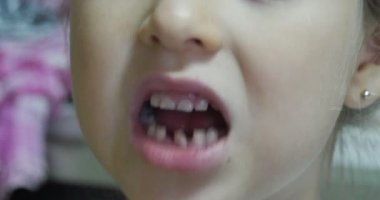 Diş titrek diş çocuğun kaybetme ağız yakın kızın yüzü yakın gözler kız kadar ağzını ve dişi tarafından dişlerini dokunmadan parmak sallayarak açtı