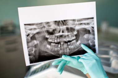 Kapalı kadın dişçi elinde hasta ağzı dijital film tutuyor. Kadın doktor hasta ağız taraması gösteriyor.