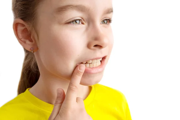 Liten flicka står på en vit bakgrund med ett vackert leende, barn krokiga tänder, pediatrisk tandvård. Krokiga tänder närbild. Korrigering av malocklusion krävs. — Stockfoto