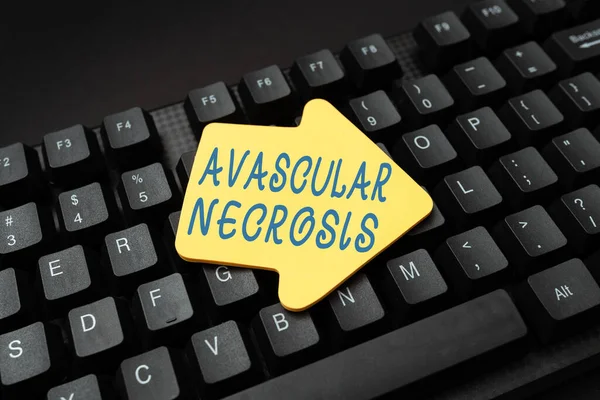 Sign displaying Avascular Necrosis. Business overview death of bone tissue due to a lack of blood supply Online Browsing And Exploring, Creating Blog Content, Sending New Messages — Fotografia de Stock