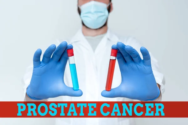 Scrittura visualizzazione del testo Cancro alla prostata. Idea di business cancro si sviluppa nella ghiandola del sistema riproduttivo maschile Research Scientist Confronto diversi campioni, medico visualizzazione cura — Foto Stock