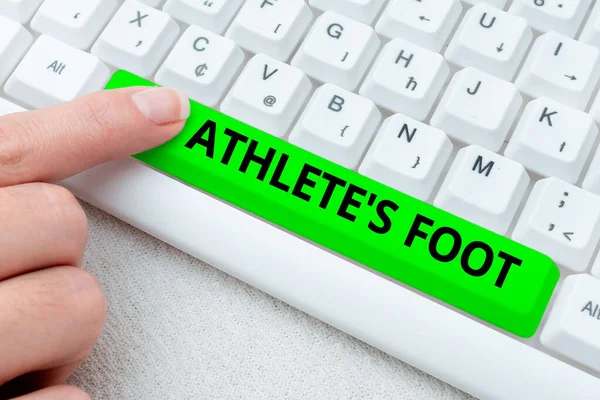 Текст почерка Athlete S Is Foot. Концепция бизнеса грибковая инфекция стопы, отмеченная волдырями Абстрактный офис Ввод рабочих мест, пишущая машинка Важные рабочие отчеты — стоковое фото