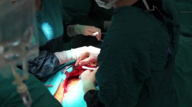 sahne bir işlemin, cerrahi serisi 31 Hd 1080 p