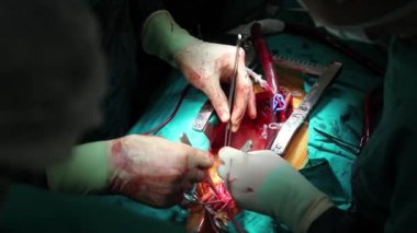 sahne bir işlemin, cerrahi serisi 24 Hd 1080 p