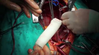 sahne bir işlemin, cerrahi Serisi 21 hd 1080p