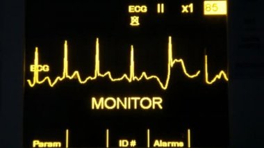 gerçek ekg monitör hd 1080p