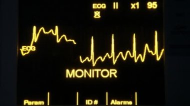 gerçek ekg monitör slowmotion hd 1080p