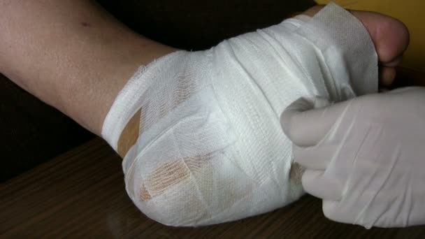 Arzt bandagiert diabetischen Fuß — Stockvideo