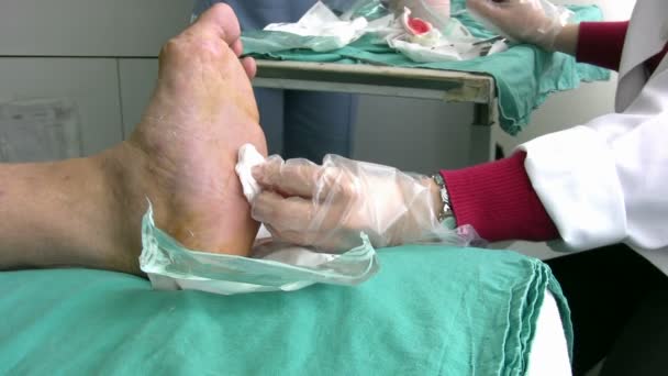 Injured Diabetic Foot — Stock Video