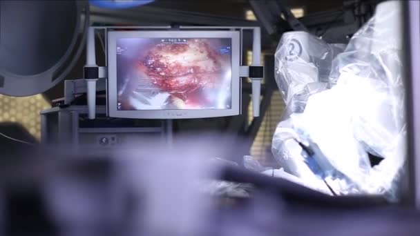 Robot Médico Cirugía Robótica Operación Médica Con Robot Cirugía Robótica — Vídeo de stock