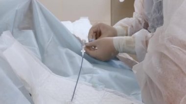 KYIV UKRAINE - 8 Haziran 2021: Kalp hastalığının teşhisinde modern teknoloji. Anjiyografi. Müdahaleci kardiyoloji. Bir anjiyo-editoryal görüntüde etkilenen koroner arterin lekelenmesi