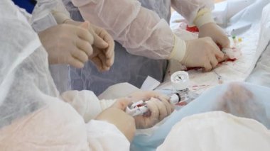 KYIV UKRAINE - 8 Haziran 2021: Kalp hastalığının teşhisinde modern teknoloji. Anjiyografi. Müdahaleci kardiyoloji. Bir anjiyo-editoryal görüntüde etkilenen koroner arterin lekelenmesi