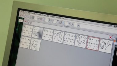 Bilgisayar araştırma hastanesinde hasta kişinin kromozom
