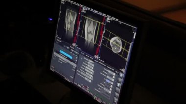 CAT taraması monitör oda. Manyetik rezonans görüntüleme tıbbi klinik araştırma. MRI tarama