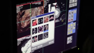 Manyetik rezonans görüntüleme tıbbi klinik araştırma. Kalp ve kalp damar bir çalışma. MRI tarama 3D. CAT taraması monitör Oda