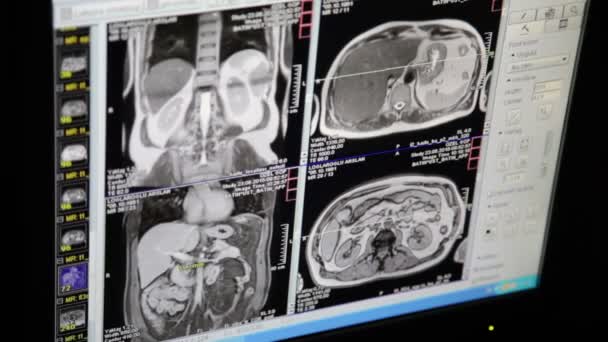 CT Monitor szoba. Mágneses rezonancia képalkotás az orvosi rendelő a kutatás. MRI-vizsgálat — Stock videók