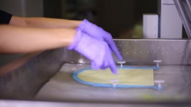 Beyin radyasyon therap. net MRI için - stok Video sabitleme