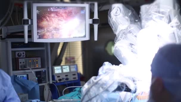 Robotic Surgery. Robot medyczny. Medycznych czynności obejmujących robota - film akcji — Wideo stockowe